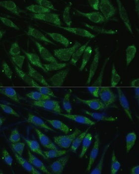 PITRM1 Antibody