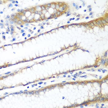 PPP4R1 Antibody