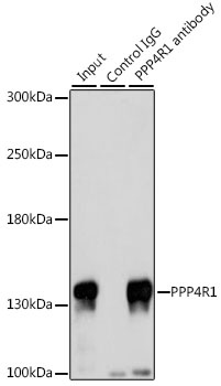 PPP4R1 Antibody