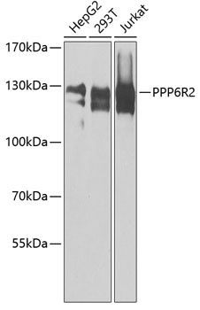PPP6R2 Antibody