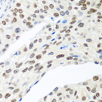 MDC1 Antibody