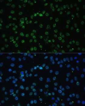 DDX39B Antibody