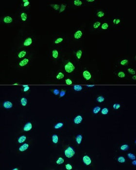 DDX39B Antibody