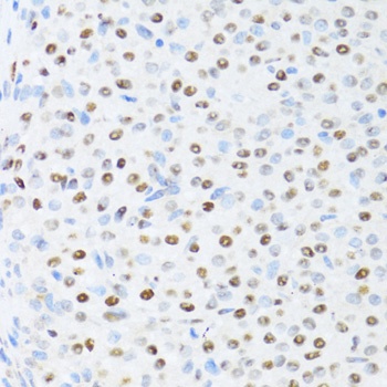 DDX39B Antibody