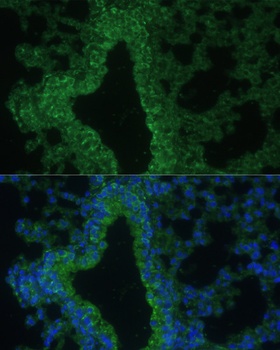 DDX39B Antibody