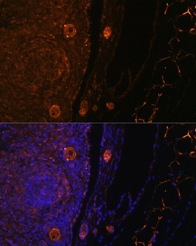 ZP3 Antibody