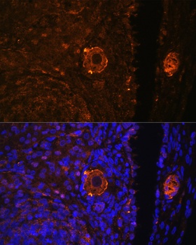 ZP3 Antibody