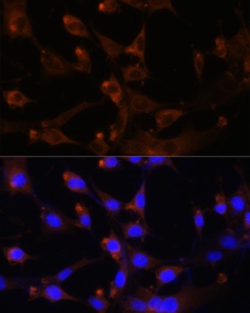 CAD Antibody