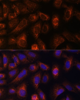 CAD Antibody