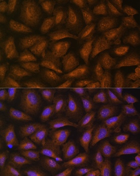 CAD Antibody