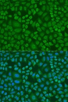DROSHA Antibody