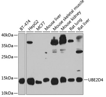 UBE2D4 Antibody