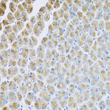 AP1M2 Antibody