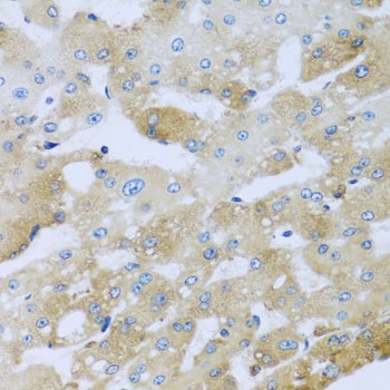 AP1M2 Antibody