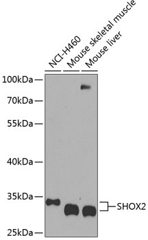 SHOX2 Antibody