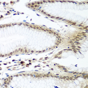PTTG1 Antibody