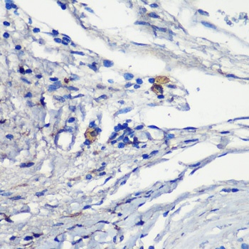MRC1 Antibody