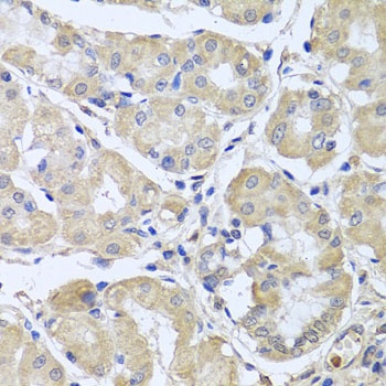 CEP57L1 Antibody