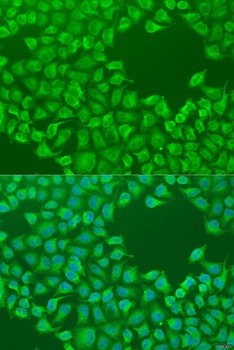 CEP57L1 Antibody