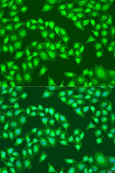 RSAD2 Antibody