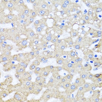 ARL6 Antibody