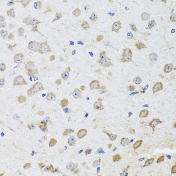 ARL6 Antibody