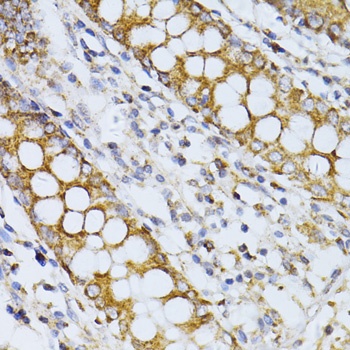 CCDC92 Antibody