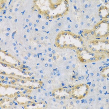 HS1BP3 Antibody