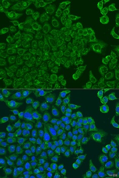 ALOXE3 Antibody