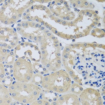 CHMP1B Antibody