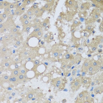 CHMP1B Antibody