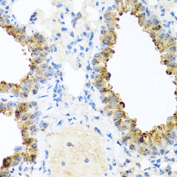 NIN Antibody