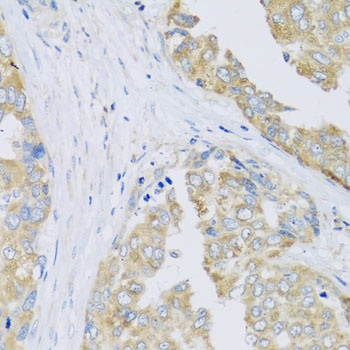 ARFGAP3 Antibody