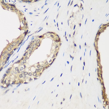 METTL7A Antibody