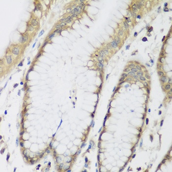 METTL7A Antibody