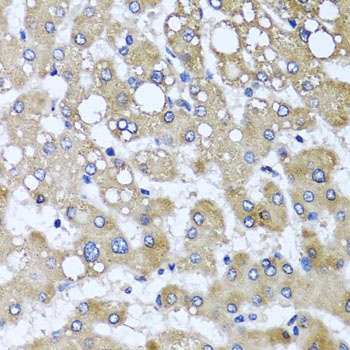TTLL12 Antibody
