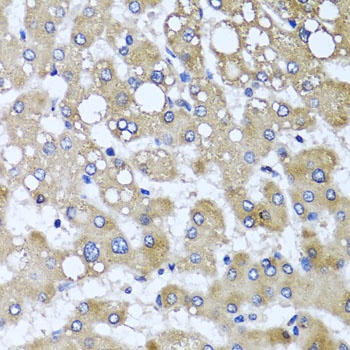 TTLL12 Antibody