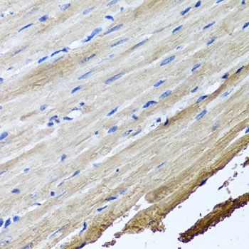 TTLL12 Antibody