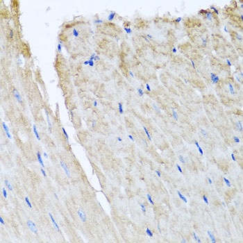 TTLL12 Antibody