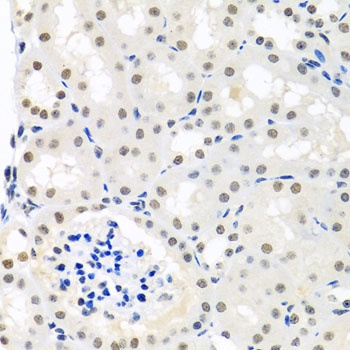 THOC1 Antibody