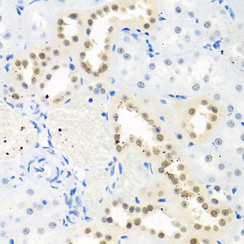 THOC1 Antibody