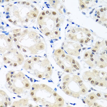 THOC1 Antibody