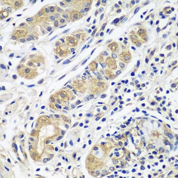GPRC5A Antibody