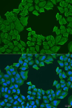 STXBP3 Antibody