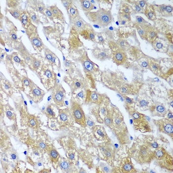 SGSH Antibody