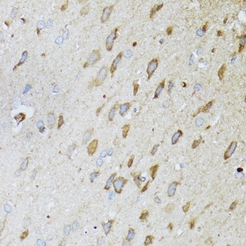 MT-ND5 Antibody