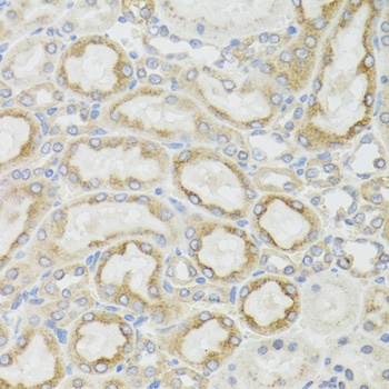 MT-ND5 Antibody