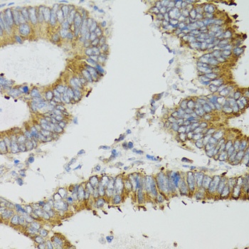 MT-ND5 Antibody