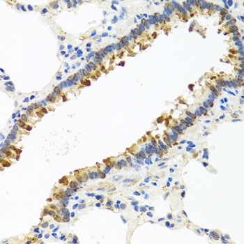 CST4 Antibody