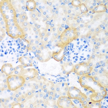 CEACAM7 Antibody